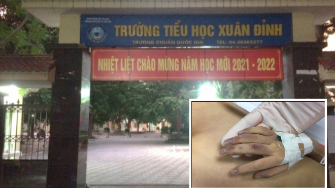 Vụ cháu 6 tuổi ở Hà Nội chết nghi do bị bạo hành: Khởi tố, bắt tạm giam người bố
