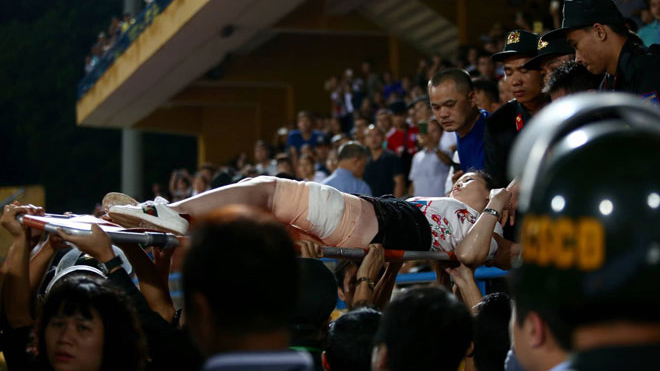 Tin tức, CĐV Nam Định đốt pháo sáng, Hà Nội vs Nam Định, bóng đá việt nam, Vleage 2019, V-league 2019, CĐV Nam Định, bong da, án phạt cho CĐV Nam Định, CĐV nhập viện